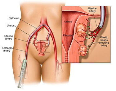 aishah alwi add uterus porn image