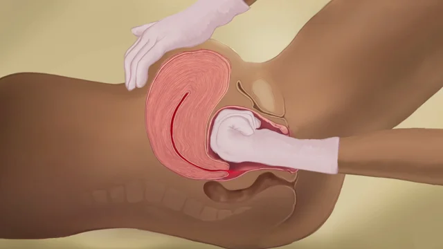 ann sheahan add uterus porn image